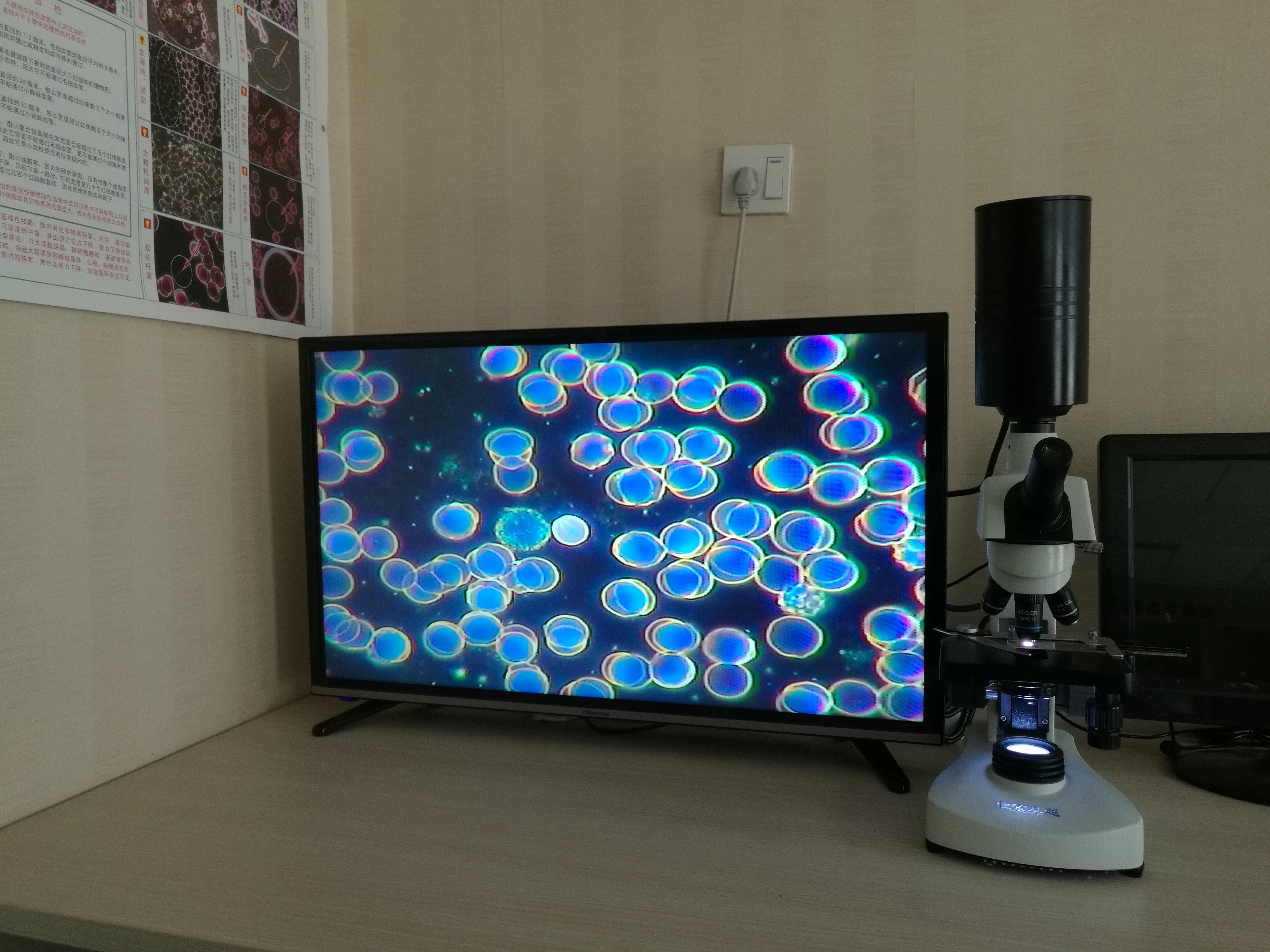 北京*GLS黑背景一滴血檢測儀