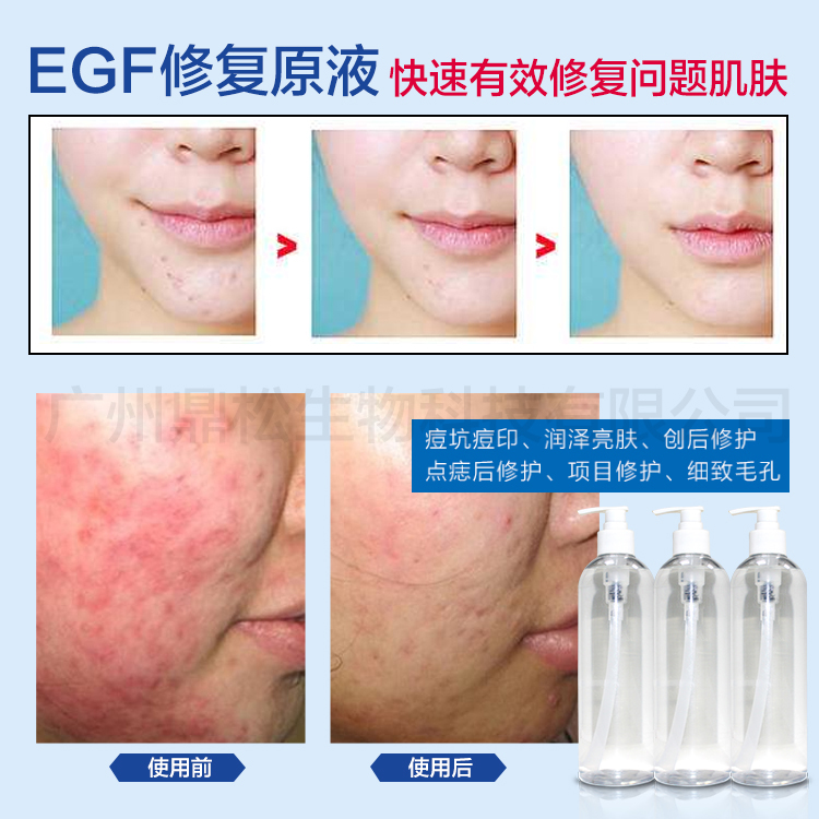 EGF修復原液醫(yī)美級去痘印修復細致毛孔滋潤皮膚工廠批發(fā)貼牌加工