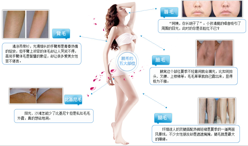 OPT脫毛儀這么火-效果真能永1久嗎？