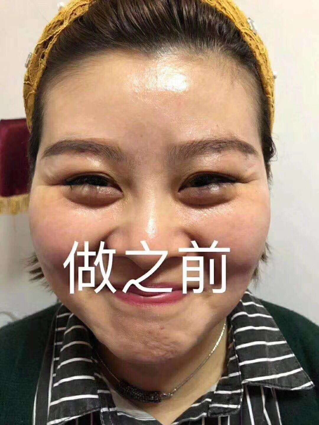 薇琴細(xì)胞美療·去皺抗衰_山東薇琴去皺薇琴抗衰招商加盟_魔皺薇琴哪個(gè)更好