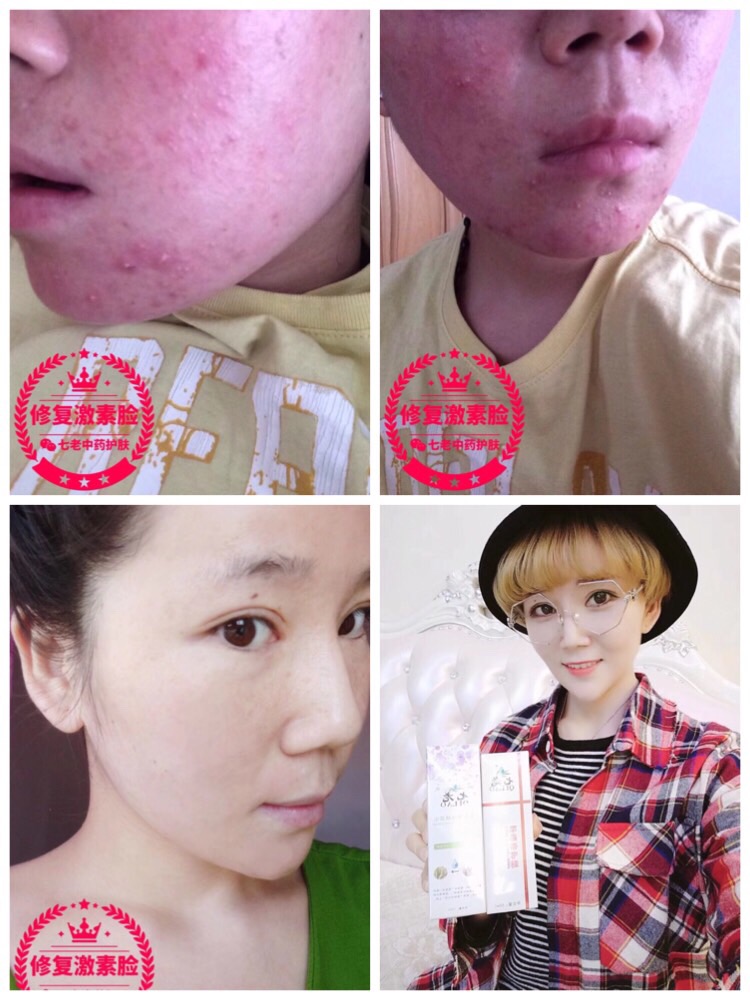 七老總經(jīng)銷燕子13590760279哪里有七老實(shí)體店？中山有實(shí)體店嗎？怎么加盟？