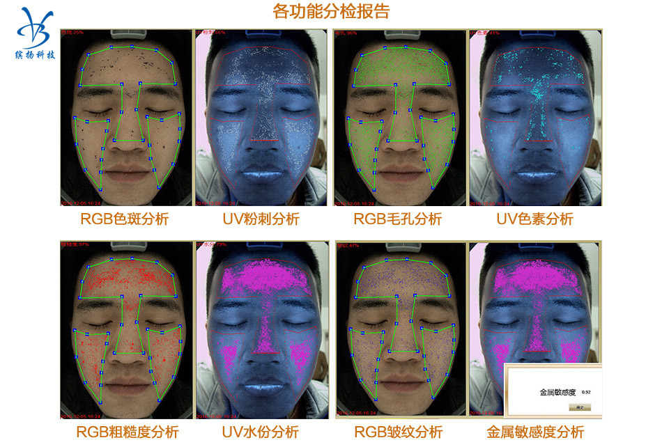 魔鏡皮膚檢測(cè)儀圖像分析系統(tǒng)，分析診斷皮膚問(wèn)題