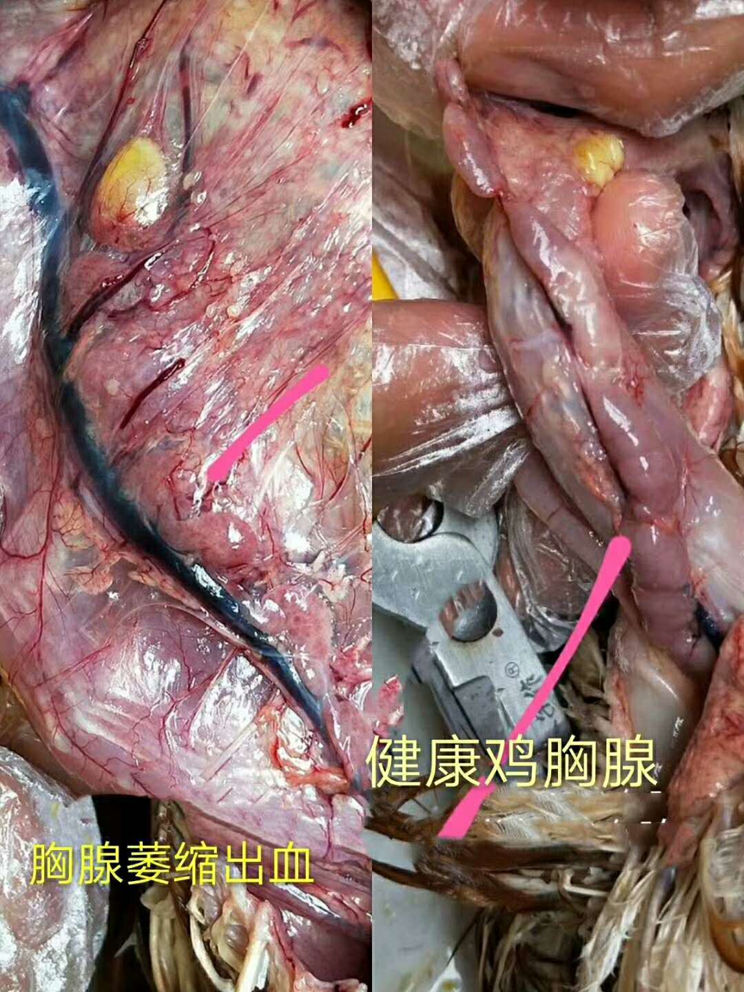 腺肌胃炎，癱雞，熱應(yīng)激，肝病，腸道病，霉菌*是萬(wàn)病之源. 料中寶，胃康靈，河南陽(yáng)光，霉菌