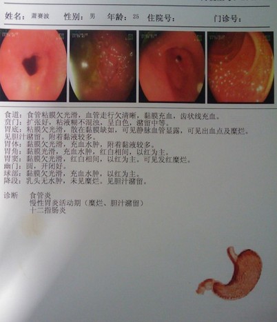 供應(yīng)OKIC711n醫(yī)用膠片打印機(jī)  OKIC711n膠片打印機(jī)  OKIC711n膠片打印機(jī)