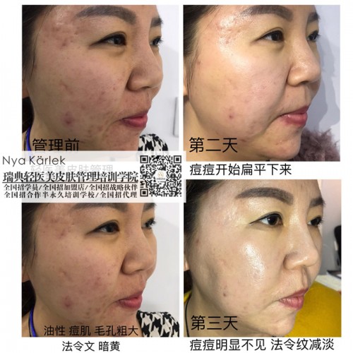 瑞典NK中國總部_瑞典NK輕醫(yī)美皮膚管理培訓加盟模式瑞典輕醫(yī)美*運營中國總部