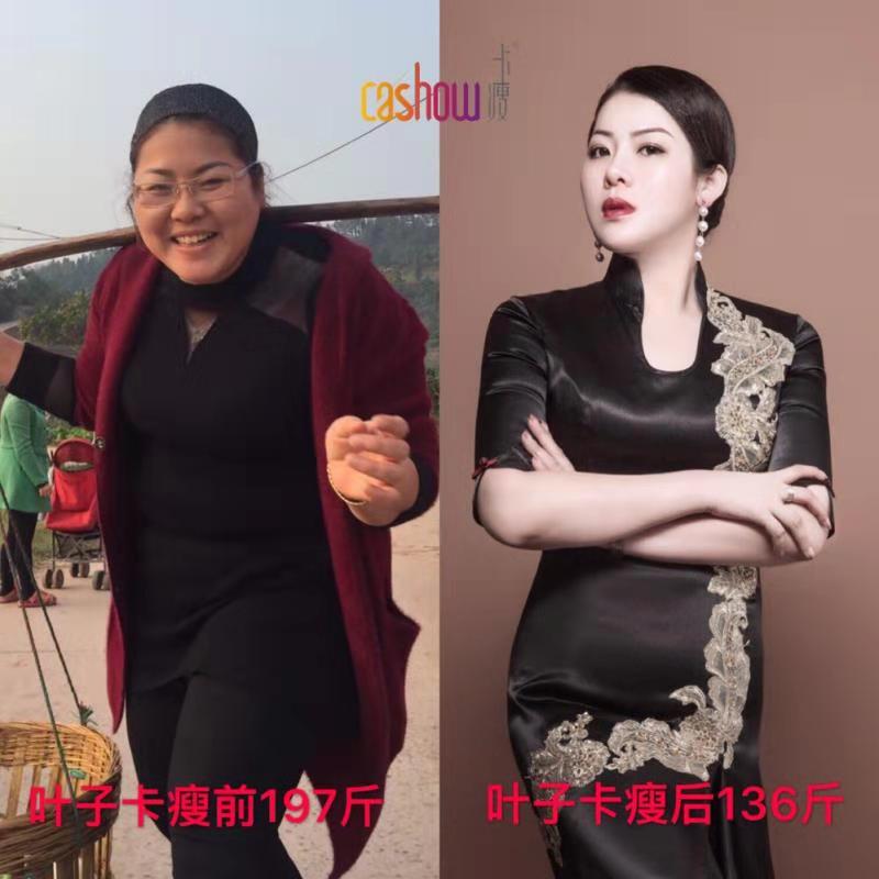 卡瘦棒|卡瘦棒銷售|卡瘦棒價格|卡瘦棒代理|北京卡瘦棒|卡瘦棒供應(yīng)商|卡瘦棒系列|卡瘦棒供貨商 卡瘦棒廠家直銷