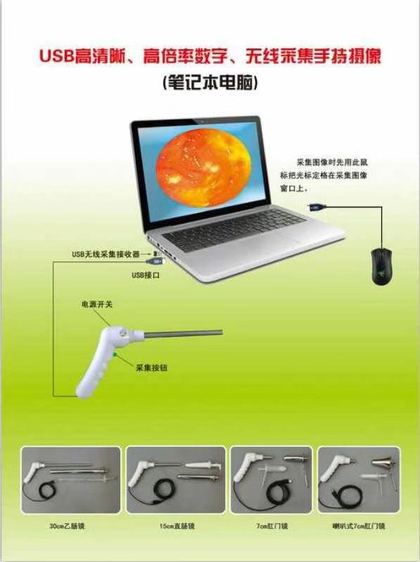 7公分直筒肛腸鏡批發(fā)，山東7公分直筒肛腸鏡批發(fā)，濟(jì)南7公分直筒肛腸鏡批發(fā)
