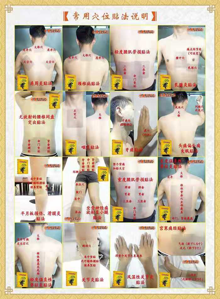 黑虎鉆風(fēng)藥膏