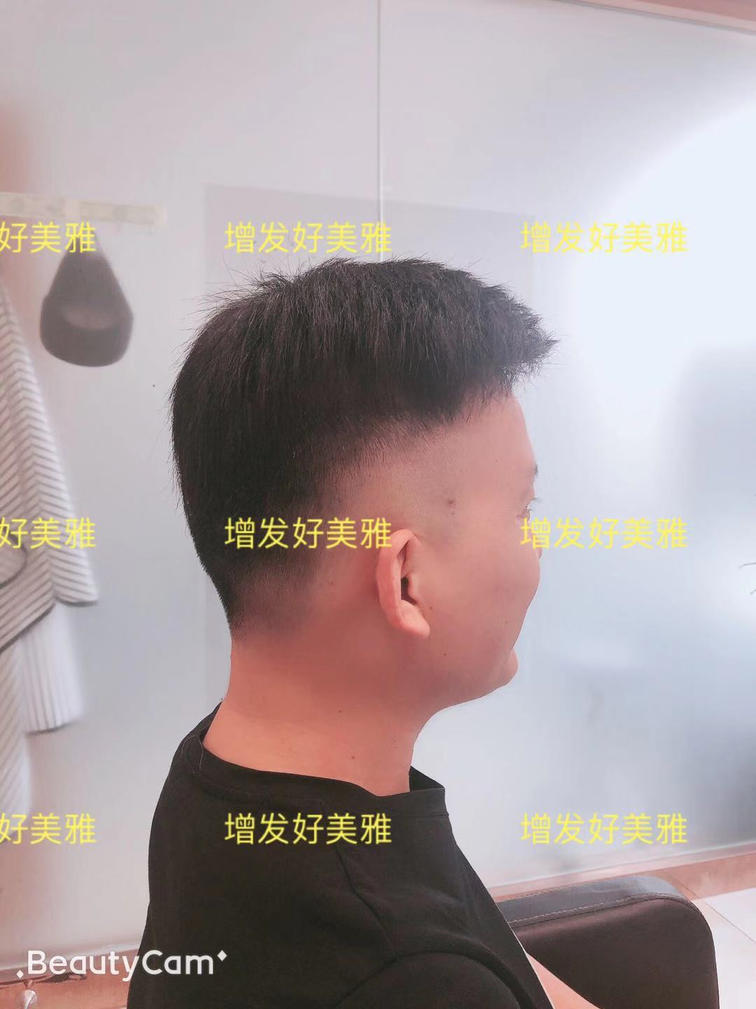 鳳岡假發(fā)織發(fā)@電話(huà)@價(jià)格