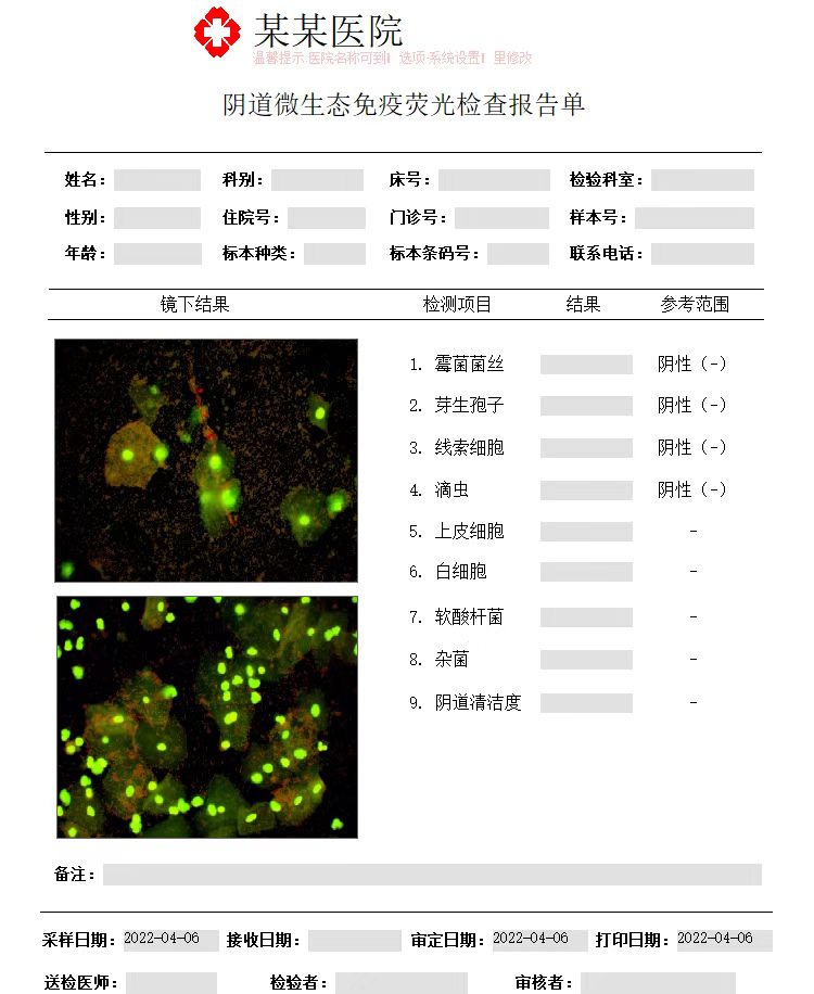 白帶分析儀